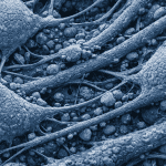 preservar tu cerebro para «resucitar» en el futuro