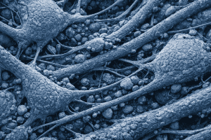 preservar tu cerebro para «resucitar» en el futuro